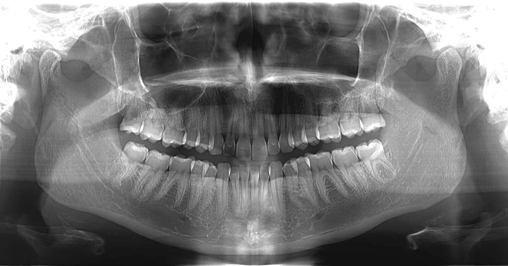 ct and cbct